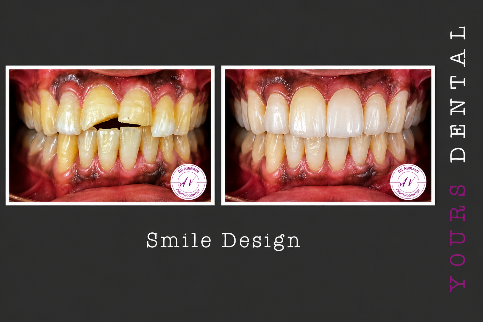 Cosmetic Dentistry
